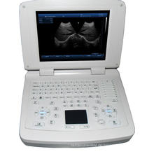 Volldigitaler Laptop-Ultraschallscanner